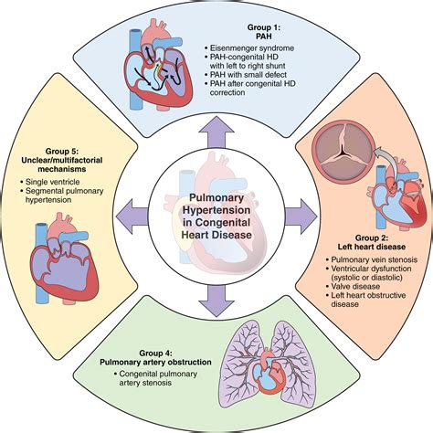 congenital hd|congenital heart disease genetics.